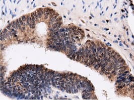 QPRT Antibody (clone OTI7A8)
