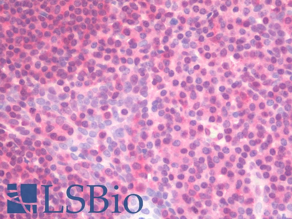 IHC-plus™ PSMB9 Antibody (clone 1C4)