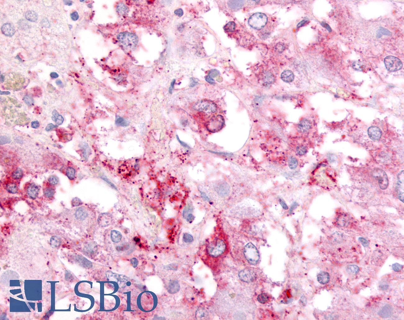IHC-plus™ GPR182 / ADMR Antibody