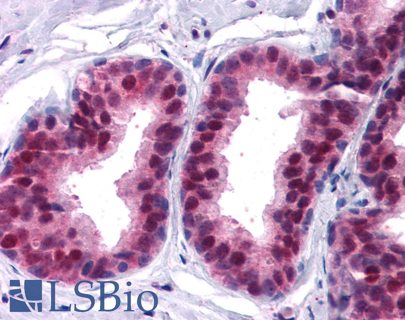 IHC-plus™ Polyclonal Goat anti-Human CDKN1B / p27 Kip1 Antibody (aa153-165, IHC, WB)