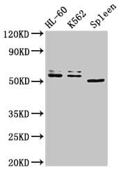 Polyclonal Rabbit anti-Human API5 Antibody (IF)