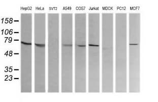 Monoclonal Mouse anti-Human COG6 Antibody (clone OTI1B8, IHC, IF, WB)