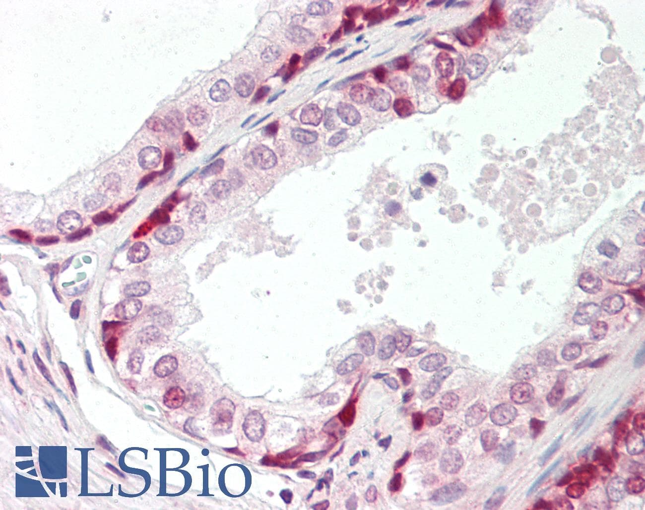 HDLBP / Vigilin Antibody (aa1079-1128)