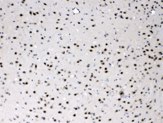 PSMA3 Antibody