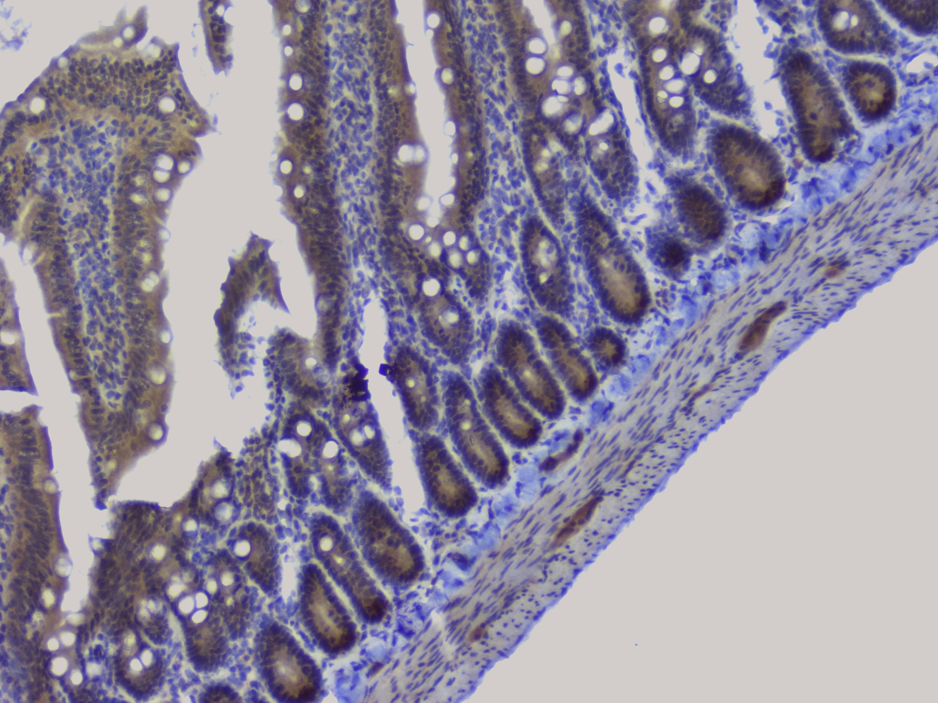 NRF1 / NRF-1 Antibody