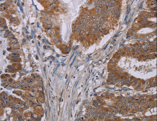 NOX3 Antibody