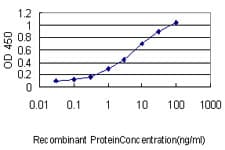 Monoclonal Mouse anti-Human MEIS2 Antibody (clone 1H4, IHC, IF, WB)