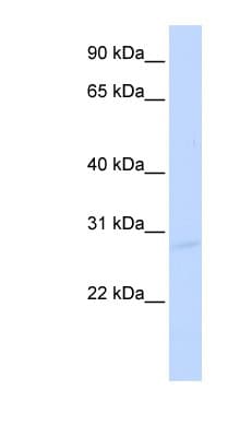 SPIC Antibody (C-Terminus)