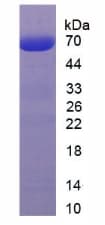 Human RYR1 / RYR Protein (Recombinant His, N-Terminal)