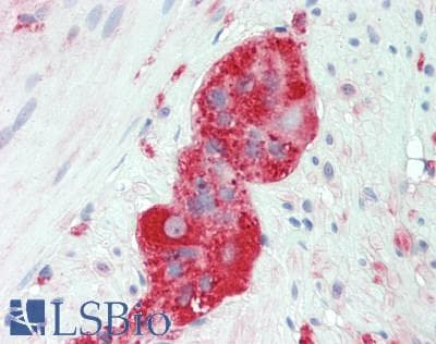 IHC-plus™ LAMA4 / Laminin Alpha 4 Antibody (aa1474-1508)