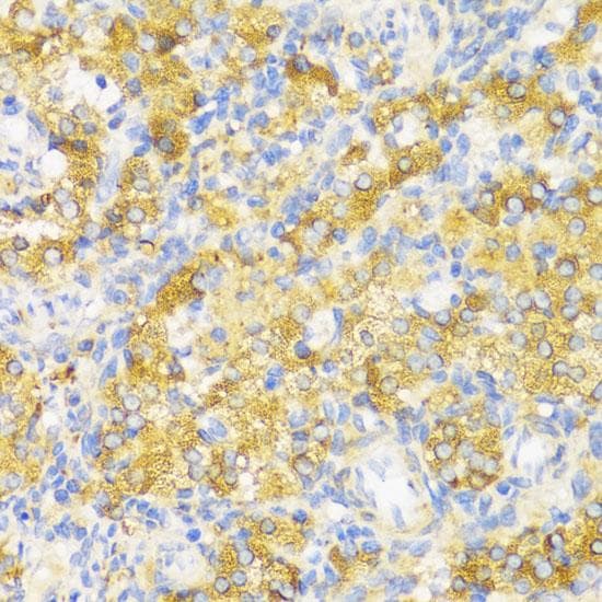 Polyclonal Rabbit anti-Human HLA-DPB1 Antibody (IHC)