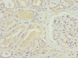 SLC12A6 / KCC3 Antibody