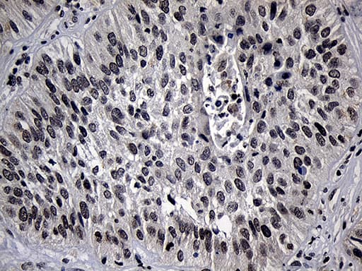 ELL / MEN Antibody (aa302-621, clone OTI3A8)