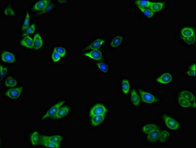 HnRNPLL / HNRPLL Antibody