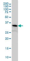 Monoclonal Mouse anti-Human PIH1D1 Antibody (clone 1E8, IHC, WB)