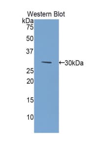 GSTM2 Antibody (aa3-218)