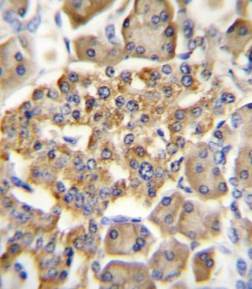 GIPR / GIP Receptor Antibody (aa7-38)