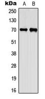 Polyclonal Rabbit anti-Human CEP70 Antibody (Internal, IHC, WB)