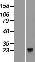 AKIP1 / BCA3 Protein (Over-Expression Lysate Myc-DDK (Flag))