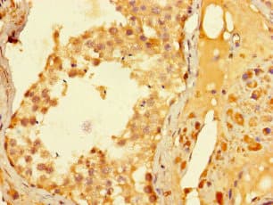 ELAC1 Antibody