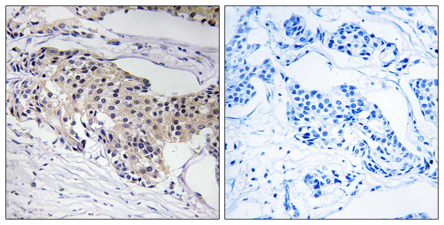 NDUFA3 / B9 Antibody (aa34-83)