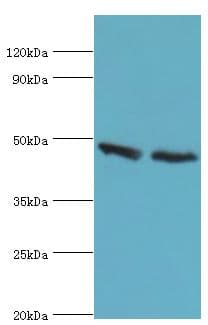 IHC-plus™ FDFT1 / Squalene Synthase Antibody (aa1-260)