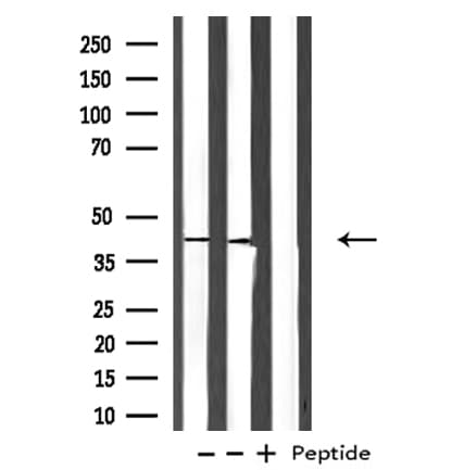 PRLTS / PDGFRL Antibody