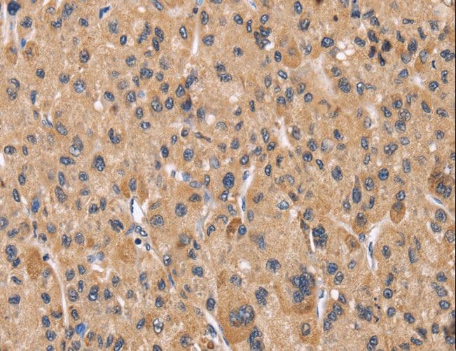 PPIF / Cyclophilin F Antibody