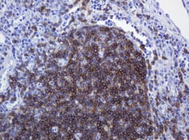 CD79A / CD79 Alpha Antibody (clone OTI5E2, Carrier-free)