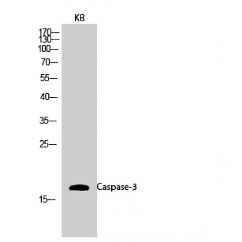 CASP3 / Caspase 3 Antibody (90-170 aa)