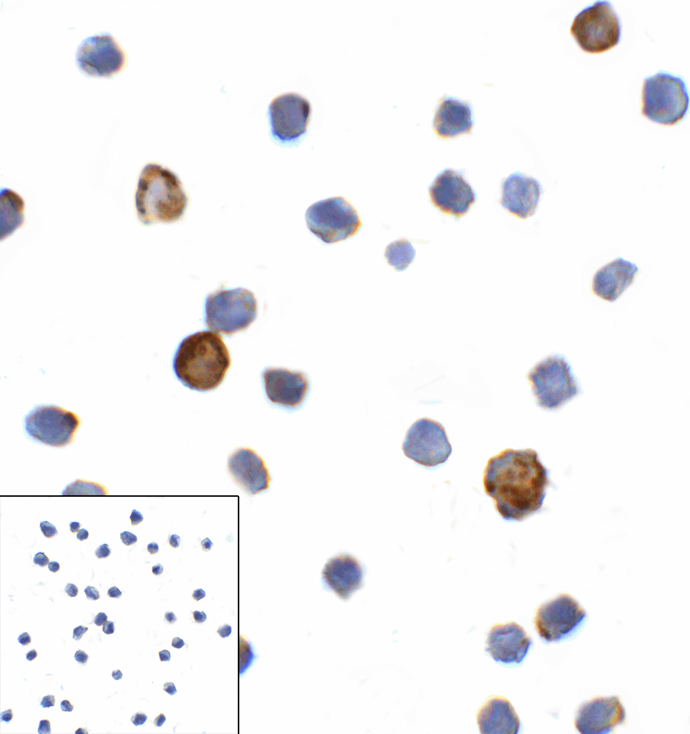 LAG3 Antibody (clone 1G4)