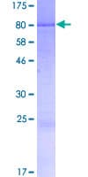Human IFIX / PYHIN1 Protein (Recombinant GST)