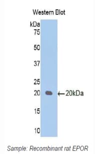 EPOR / EPO Receptor Antibody (aa314-467, Biotin)