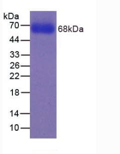 Human CYP2E1 Protein (Recombinant His)