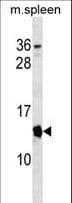 Polyclonal Rabbit anti-Mouse p19ARF (Mouse Cdkn2a) Antibody (aa39-65, WB)