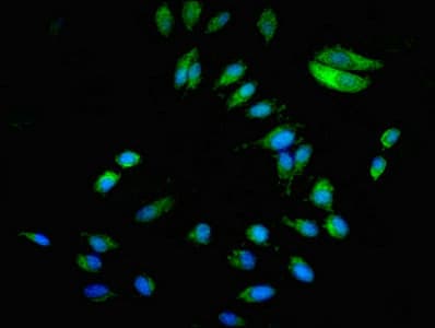 Polyclonal Rabbit anti-Human BCAR1 / p130Cas Antibody (IHC, IF, WB)