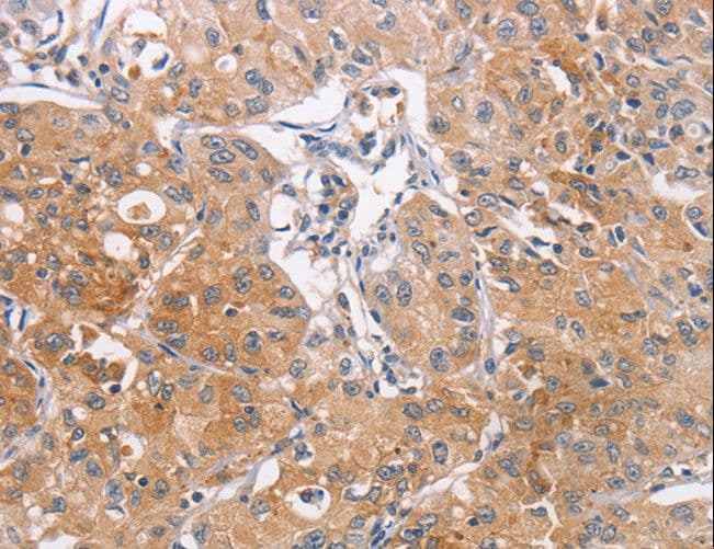 Polyclonal Rabbit anti-Human CDCA4 Antibody (IHC)