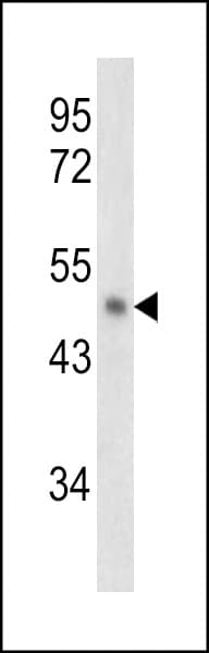 SERPINB2 / PAI-2 Antibody (aa116-144)