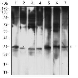 HTRA2 / OMI Antibody (clone 6H7A8)