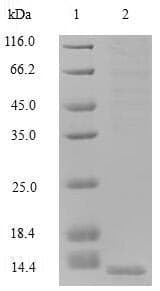 Human GUCA2B / Uroguanylin Protein (Recombinant 6His, N-terminus)