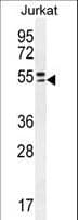 TRIM59 Antibody (aa68-96)