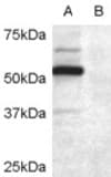 IHC-plus™ Polyclonal Goat anti-Human DCDC2 Antibody (aa352-365, IHC, WB)