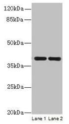CCDC42 Antibody (Coiled-coil domain)