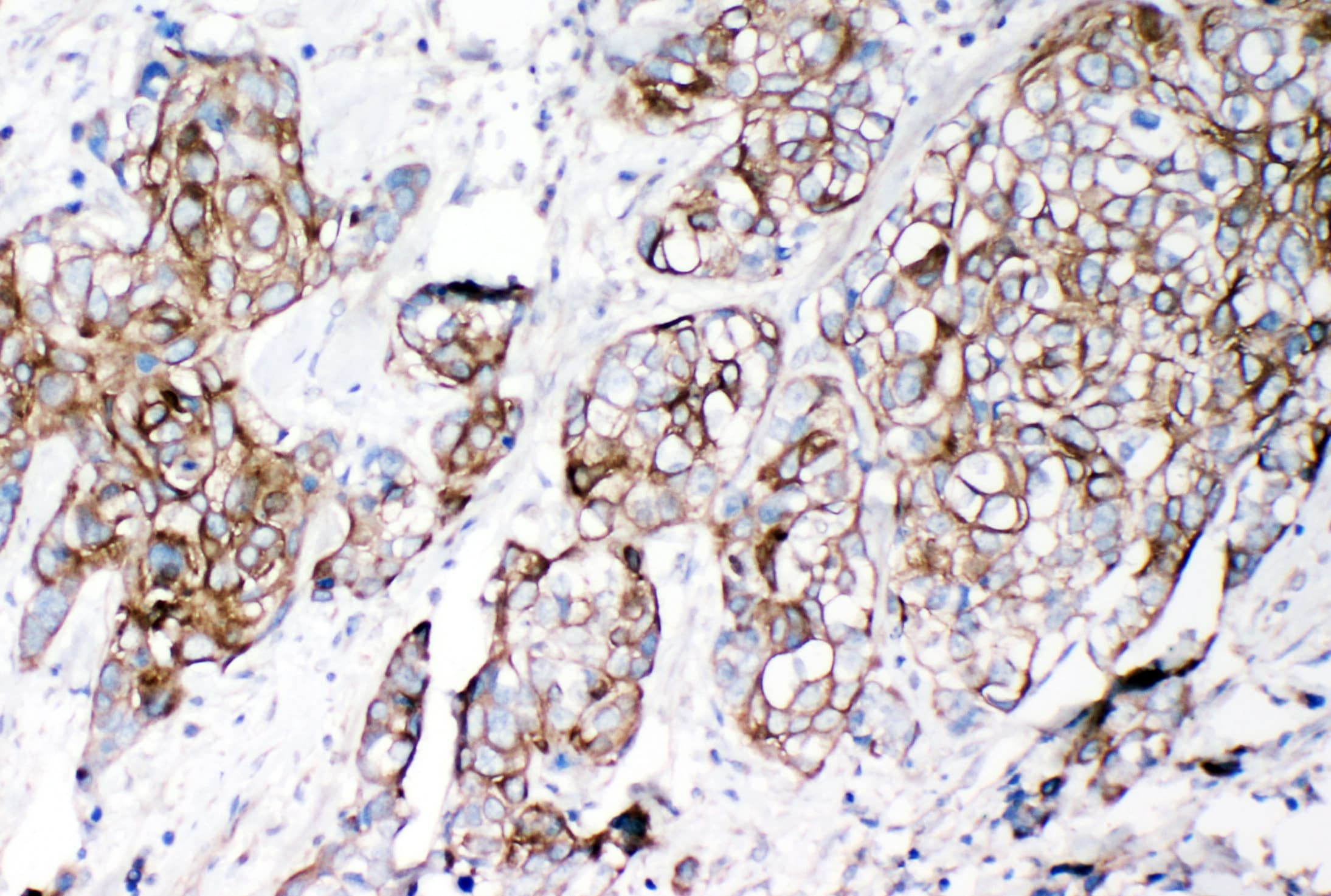 CD144 / CDH5 / VE Cadherin Antibody (aa766-784)