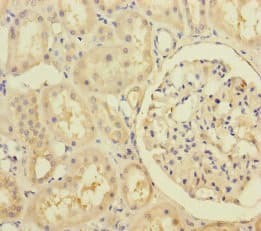 RIC8A Antibody