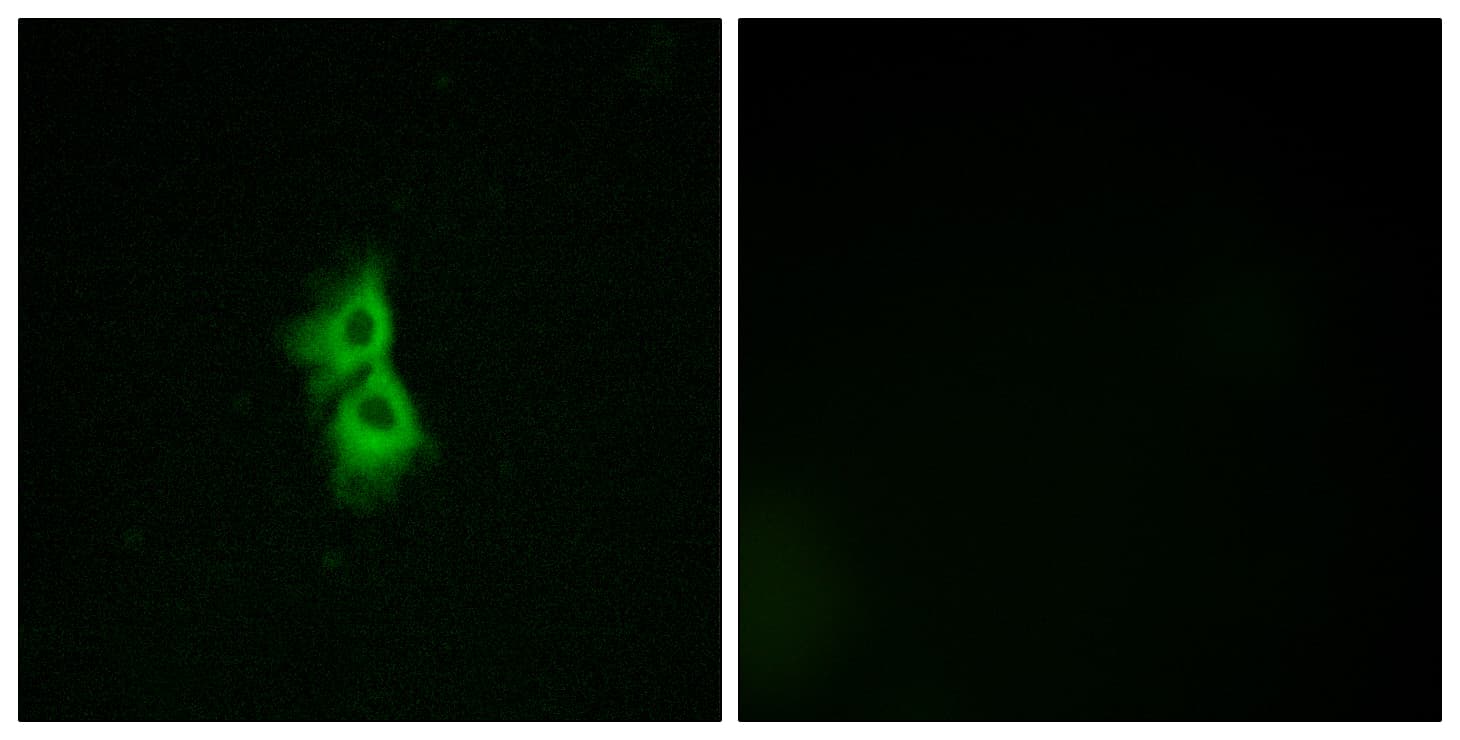 Polyclonal Rabbit anti-Human GPR22 Antibody (aa271-320, IF)