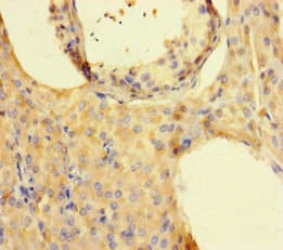 Polyclonal Rabbit anti-Human ISPD / Nip Antibody (IHC, IF)