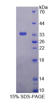 Human TPI1 / TPI Protein (Recombinant His-T7)