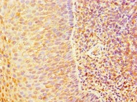 ABCB2 / TAP1 Antibody (aa524-808)