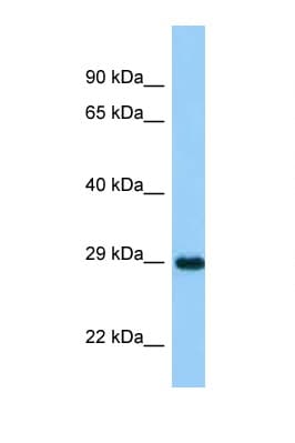 ASB11 Antibody (aa21-70)